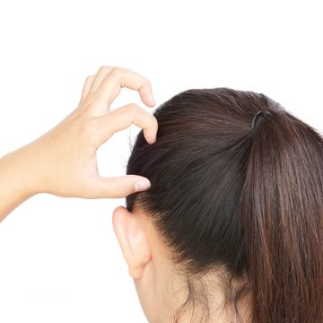頭皮にかさぶたができるのは頭皮湿疹？考えられる原因や対処方法